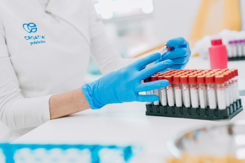 NIPT testovi i što sve budući roditelji trebaju znati o njima